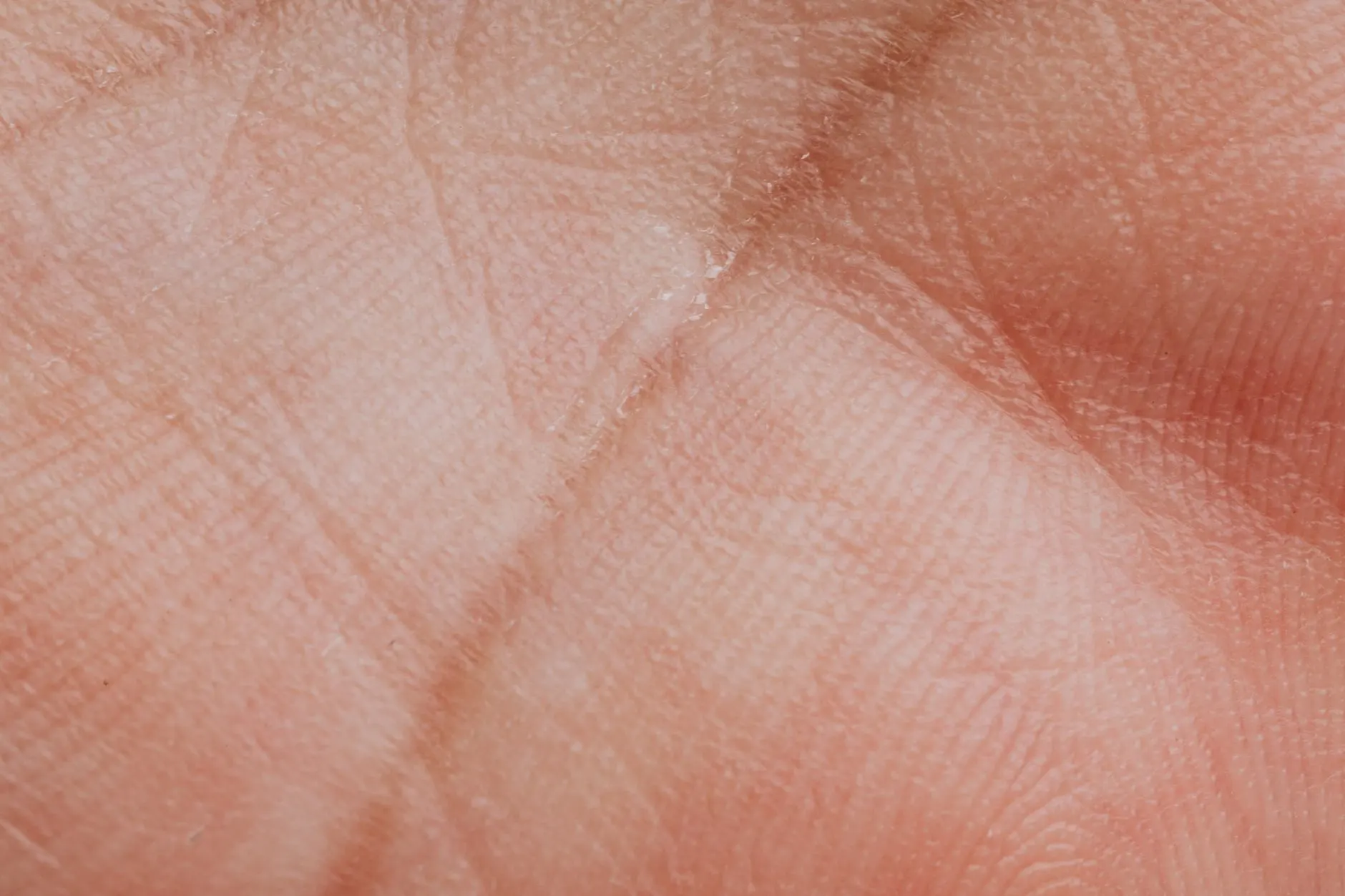 智汇奇策企业财务软件光盘：预算管理与利润分析的技术架构解析